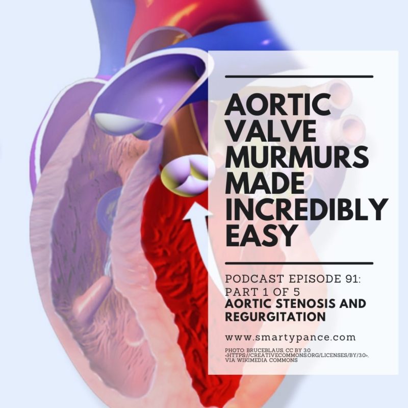 Aortic-Valve-Murmurs-Made-Incredibly-Easy-Audio-PANCE-and-PANRE-Podcast-Episode-91