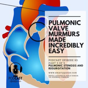 Podcast Episode 93 Murmurs Made Incredibly Easy (Part 3 of 5) – Pulmonary Valve Stenosis and Regurgitation - Smarty PANCE